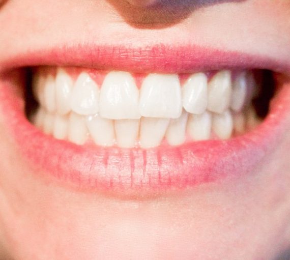 Złe nawyki, które niszczą twoje zęby